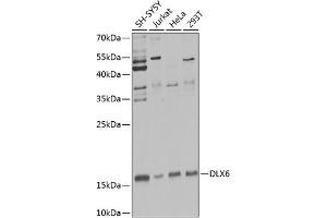 Western blot analysis of extracts of various cell lines, using DLX6 Antibody (ABIN6131792, ABIN6139675, ABIN6139676 and ABIN6223589) at 1:1000 dilution. (DLX6 Antikörper  (AA 119-293))