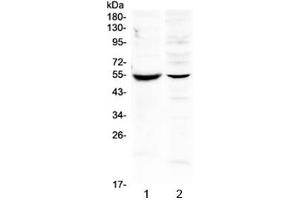 Western blot testing of 1) mouse intestine and 2) human SMMC-7721 lysate with MMP16 antibody at 0. (MMP16 Antikörper)