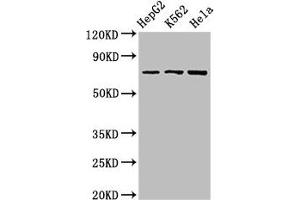 Western Blot Positive WB detected in: HepG2 whole cell lysate, K562 whole cell lysate, Hela whole cell lysate All lanes: DBF4 antibody at 2. (DBF4 Antikörper  (AA 101-281))