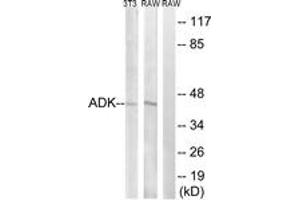 Western blot analysis of extracts from RAW264. (ADK Antikörper  (AA 1-50))