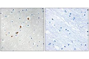 Immunohistochemistry analysis of paraffin-embedded human brain tissue using ZNF596 antibody. (ZNF596 Antikörper  (Internal Region))