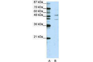WB Suggested Anti-SMAD2 Antibody Titration:  2. (SMAD2 Antikörper  (N-Term))