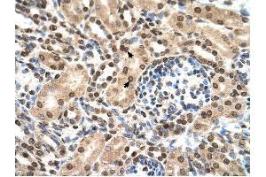IFIT3 antibody was used for immunohistochemistry at a concentration of 4-8 ug/ml to stain EpitheliaI cells of renal tubule (arrows) in Human Kidney. (IFIT3 Antikörper  (N-Term))