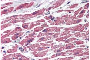 Human Heart (formalin-fixed, paraffin-embedded) stained with TSC1 antibody ABIN214539 at 2. (TSC1 Antikörper)
