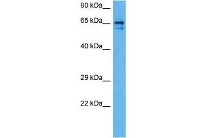 Host:  Rabbit  Target Name:  SLC6A2  Sample Tissue:  Rat Brain  Antibody Dilution:  1ug/ml (SLC6A2 Antikörper  (Middle Region))