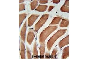 SIKE Antibody (C-term) (ABIN651568 and ABIN2840305) immunohistochemistry analysis in formalin fixed and paraffin embedded human skeletal muscle followed by peroxidase conjugation of the secondary antibody and DAB staining. (SIKE1 Antikörper  (C-Term))