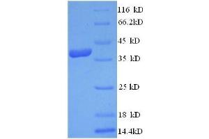 SDS-PAGE (SDS) image for C-Fos Induced Growth Factor (Vascular Endothelial Growth Factor D) (Figf) (AA 89-205), (full length) protein (GST tag) (ABIN1047904)