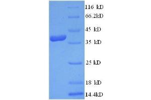 VEGFD Protein (AA 89-205, full length) (GST tag)