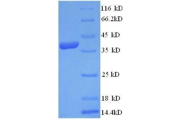 VEGFD Protein (AA 89-205, full length) (GST tag)