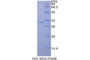SDS-PAGE analysis of Mouse MAdCAM1 Protein.