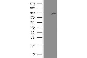 HEK293T cells were transfected with the pCMV6-ENTRY control (Left lane) or pCMV6-ENTRY DPP3 (Right lane) cDNA for 48 hrs and lysed. (DPP3 Antikörper)