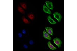 ABIN6262216 and ABIN6269364 staining Hela cells by IF/ICC. (ERBB4 Antikörper  (C-Term))