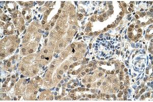 Immunohistochemistry (IHC) image for anti-T-Box 15 (TBX15) (C-Term) antibody (ABIN2783113)