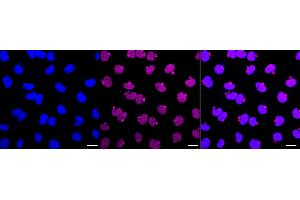 Immunocytochemical staining of Hela cells with GATAD2A antibody (ABIN7798698), 1:1,000). (Rekombinanter GATAD2A Antikörper)