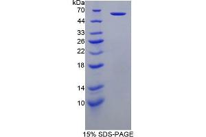 SDS-PAGE (SDS) image for Perforin 1 (Pore Forming Protein) (PRF1) (AA 32-316) protein (His tag,GST tag) (ABIN2123448) (Perforin 1 Protein (AA 32-316) (His tag,GST tag))
