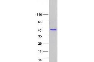 Western Blotting (WB) image for Integrin beta 1 Binding Protein (Melusin) 2 (ITGB1BP2) protein (Myc-DYKDDDDK Tag) (ABIN2723900)