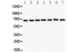 Western Blotting (WB) image for anti-Angiopoietin 1 (ANGPT1) (AA 16-350) antibody (ABIN3043724)