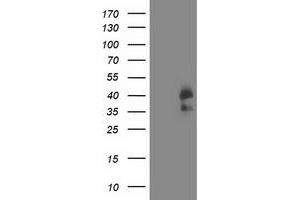 Western Blotting (WB) image for anti-Cyclin-Dependent Kinase 2 (CDK2) antibody (ABIN1497400) (CDK2 Antikörper)