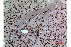 Immunohistochemistry (IHC) analysis of paraffin-embedded Rat Brain, antibody was diluted at 1:100. (Midkine Antikörper  (Internal Region))