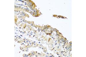 Immunohistochemistry of paraffin-embedded mouse lung using RNASE11 antibody (ABIN5970447) at dilution of 1/100 (40x lens). (RNASE11 Antikörper)