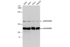 WB Image Various whole cell extracts (30 μg) were separated by 5% SDS-PAGE, and the membrane was blotted with ADAR1 antibody [N3C1], Internal , diluted at 1:1000. (ADAR Antikörper)