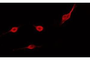 ABIN6275503 staining COLO205 cells by IF/ICC. (RHOD Antikörper  (Internal Region))