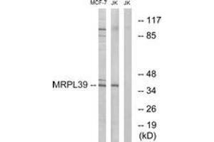 Western blot analysis of extracts from Jurkat/MCF-7 cells, using MRPL39 Antibody.
