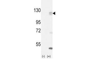Western blot analysis of FGFR antibody and 293 cell lysate (2 ug/lane) either nontransfected (Lane 1) or transiently transfected with the FGFR1 gene (2). (FGFR1 Antikörper  (AA 132-161))