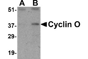 Western blot analysis of UNG2 in mouse bladder tissue lysate with UNG2 antibody at (A) 0. (Cyclin O Antikörper  (N-Term))