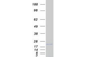 Validation with Western Blot