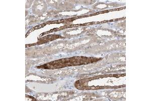 Immunohistochemical staining of human kidney with UFL1 polyclonal antibody  shows strong cytoplasmic positivity in subsets of tubules at 1:20-1:50 dilution.