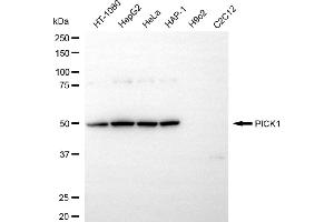 Western blotting analysis using PICK1 antibody (ABIN7799979).