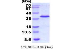 SDS-PAGE (SDS) image for Galectin 3 (LGALS3) (AA 1-264) (Active) protein (His tag) (ABIN7281081) (Galectin 3 Protein (LGALS3) (AA 1-264) (His tag))