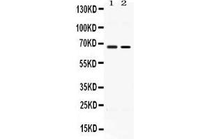 Western blot analysis of ACCN1 expression in rat testis extract ( Lane 1) and MCF-7 whole cell lysates ( Lane 2). (ACCN1 Antikörper  (N-Term))