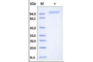 Human Cadherin-6, His Tag on SDS-PAGE under reducing (R) condition.