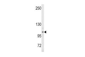 Western blot analysis of anti-EN Antibody (Center ) (ABIN389374 and ABIN2839470) in Y79 cell line lysates (35 μg/lane). (ENPP2 Antikörper  (AA 401-430))