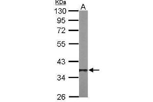Western Blotting (WB) image for anti-Protein Phosphatase 1, Catalytic Subunit, beta Isoform (PPP1CB) (Center) antibody (ABIN2856078)