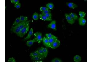 Immunofluorescence staining of HepG2 cells with ABIN7165895 at 1:133, counter-stained with DAPI. (ODR4 Antikörper  (AA 153-251))