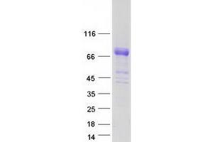 Western Blotting (WB) image for Serpin Peptidase Inhibitor, Clade G (C1 Inhibitor), Member 1 (SERPING1) (Transcript Variant 1) protein (Myc-DYKDDDDK Tag) (ABIN2731838)