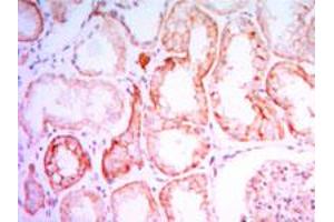 Immunohistochemical analysis of paraffin-embedded human kidney tissue using PTH1R monoclonal antobody, clone 4D2  with DAB staining.
