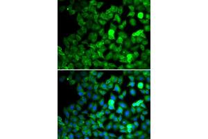 Immunofluorescence analysis of MCF-7 cells using SARS antibody. (Seryl-tRNA Synthetase (SARS) (AA 1-300) Antikörper)