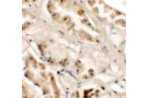 Immunohistochemistry of GZF1 in human kidney tissue with GZF1/ZNF336 Antibody at 2. (ZNF336 Antikörper  (C-Term))