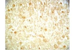 Mouse brain tissue was stained by Rabbit Anti-Metasin (1-25) (Human) / KISS-1 (68-92) (Human) Serum (KISS1 Antikörper  (AA 1-25, AA 68-92))