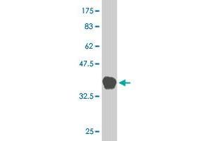 Western Blot detection against Immunogen (38. (MAP2K5 Antikörper  (AA 1-120))