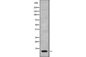 Western blot analysis MT-ATP8 using Jurkat whole cell lysates. (Mitochondrially Encoded ATP Synthase 8 (MT-ATP8) Antikörper)