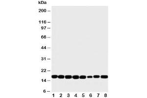 Western blot testing of NM23 antibody and rat samples 1: heart;  2: brain;  3: liver;  4: skeletal muscle; and human samples 5: PANC;  6: HeLa;  7: SKOV;  8: COLO320 cell lysate (NME1 Antikörper  (C-Term))