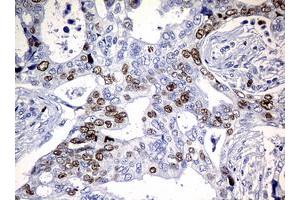 Image no. 5 for anti-Antigen Identified By Monoclonal Antibody Ki-67 (MKI67) (AA 1160-1493) antibody (ABIN1490857) (Ki-67 Antikörper  (AA 1160-1493))
