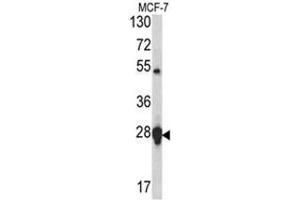 Western blot analysis of HSP27 antibody (Center) in MCF-7 cell line lysates (35ug/lane). (HSP27 Antikörper  (Middle Region))