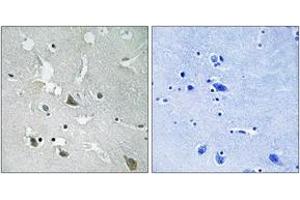 Immunohistochemistry analysis of paraffin-embedded human brain, using TIRAP (Phospho-Tyr86) Antibody. (TIRAP Antikörper  (pTyr86))