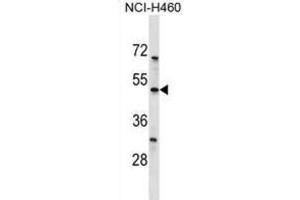Western Blotting (WB) image for anti-Potassium Channel, Subfamily K, Member 12 (KCNK12) antibody (ABIN3000027) (KCNK12 Antikörper)